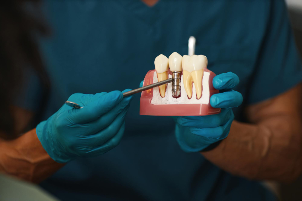 edremit diş implantı