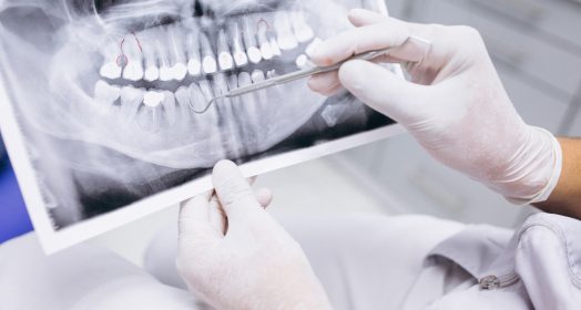 Edremit diş ağrısı tedavisi ve acil diş sağlığı hizmetleri